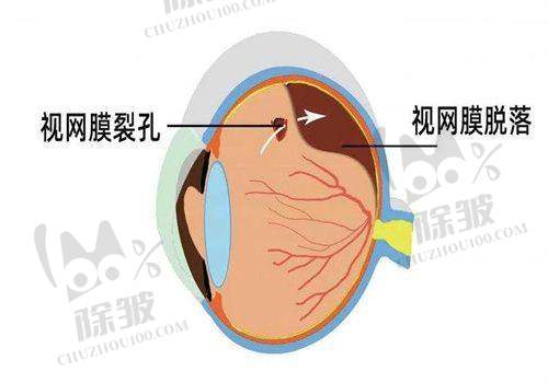 上海艾嘉瞳心眼科患者口碑