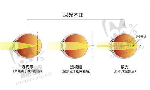 深圳光爱眼科验光收费公开