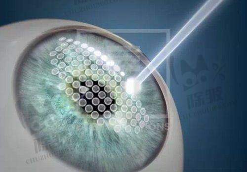 上海希玛瑞视眼科医院就医体验及费用性价比分析