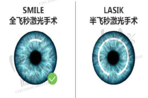 上海希玛瑞视眼科医院常见手术项目价格