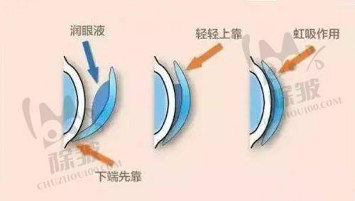 北京熙仁眼科医院地铁出行路线