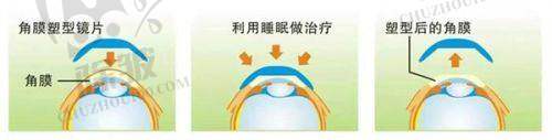 上海何氏眼科医院的地址与联系方式