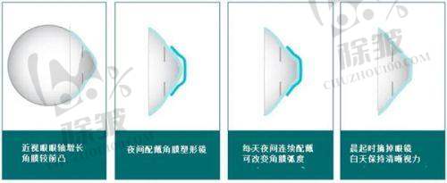 西安市第四 医院眼科医生团队介绍