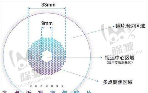 深圳光爱眼科医生团队优势