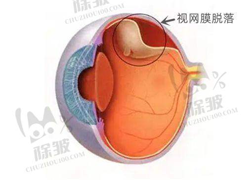 上海艾嘉瞳心眼科门诊部费用对患者选择的影响