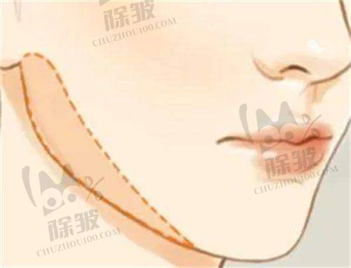 上海优嘉美医疗美容医生怎么样:经验多技艺不错