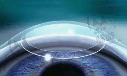 北京熙仁眼科特色项目医疗保险报销情况