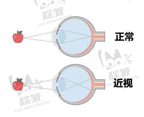 北京熙仁眼科收费与医疗保险报销综合考量