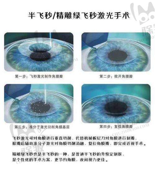 西安市第四 医院眼科双院区上班时间介绍