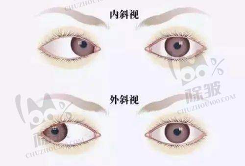 十堰市太和医院眼科特色项目及技术优势