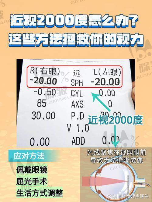 滕州启明眼科医院详细的预约挂号方式及流程