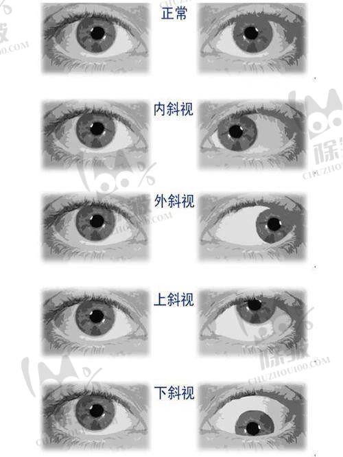 大连大学附属中山医院眼科是正规医院吗?