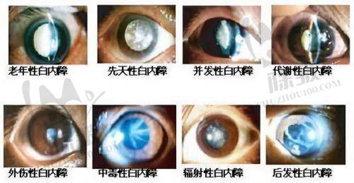 滕州启明眼科医院真人口碑评价怎么样?