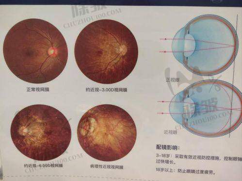大连大学附属中山医院眼科收费价格表/收费标准