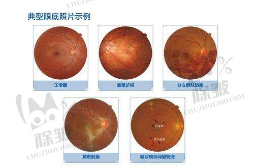 大连大学附属中山医院眼科详细的预约挂号方式及流程