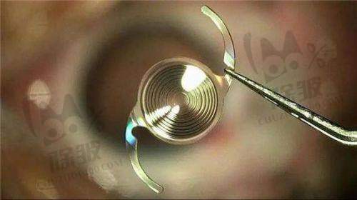 滕州启明眼科医院收费价格表/收费标准