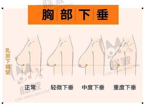 传动矫正项目