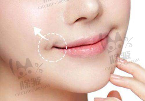 老年激素变化与男性乳房大