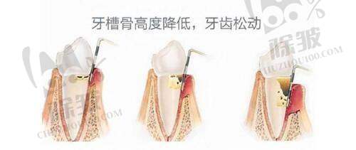 药物因素与男性乳房大