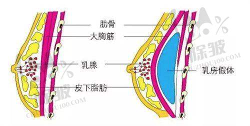其他因素与男性乳房大