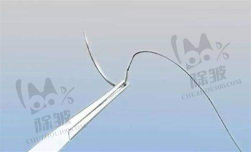 减男性雌化胸的注意事项