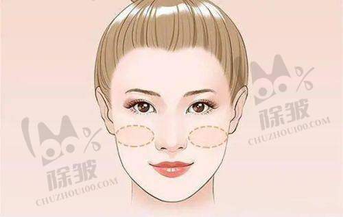 全瓷牙修复项目