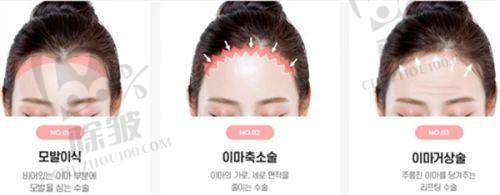 肥胖因素与男性乳房大