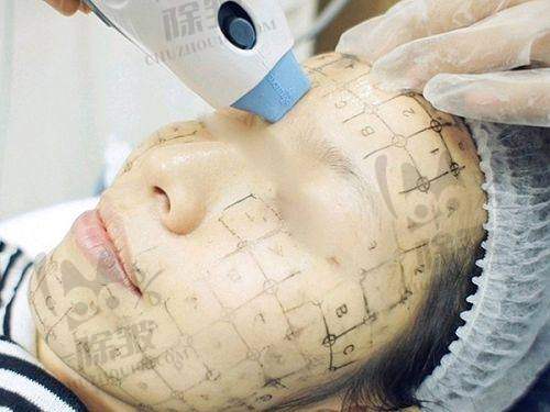 昆山容妍整形杨帆医生价格表