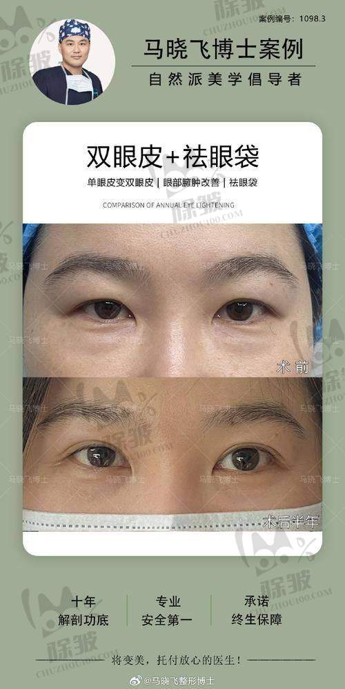 张晓棠医生价格表