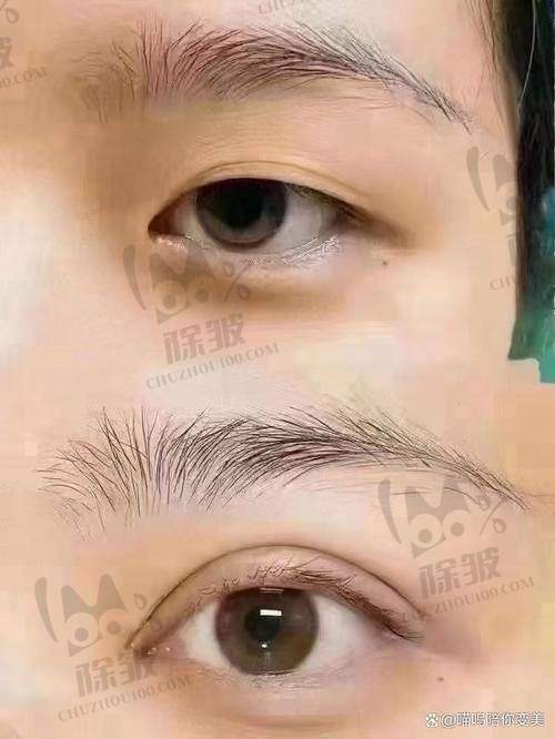 张晓棠医生擅长项目