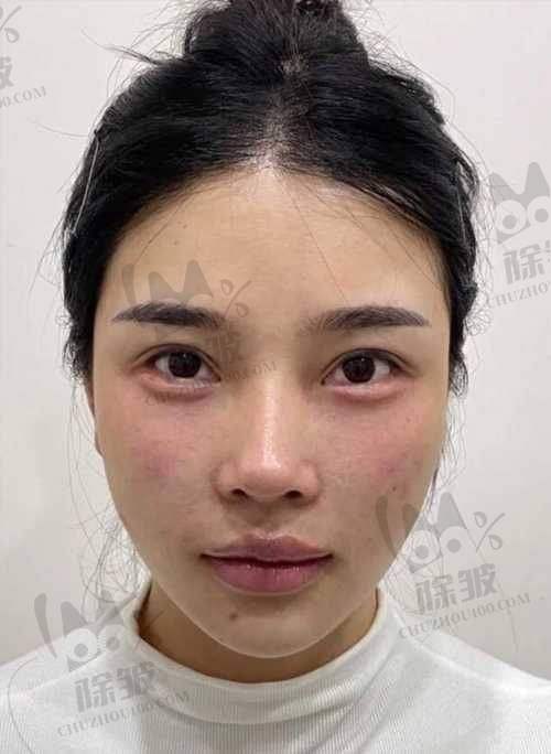 昆山容妍整形柴云医生价格表