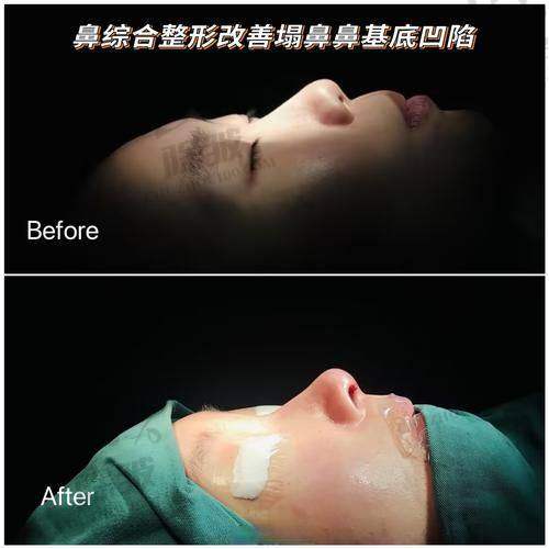 张晓棠医生预约挂号