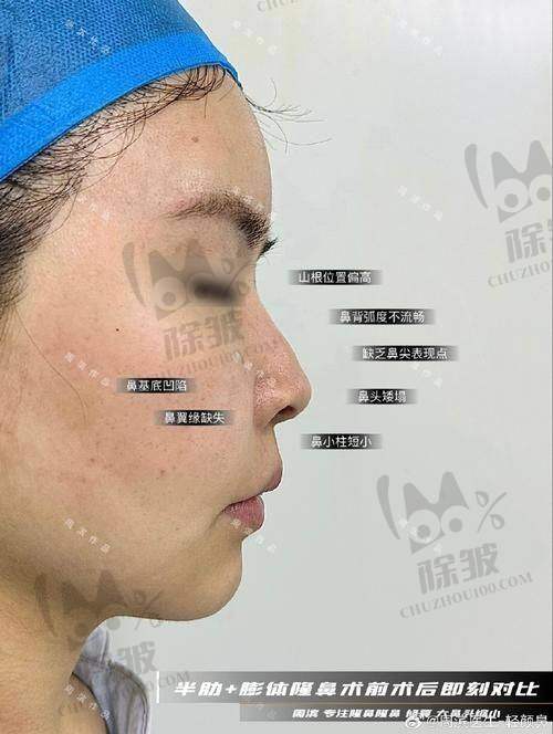 周强医生价格表