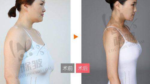 顾海峰医生擅长项目