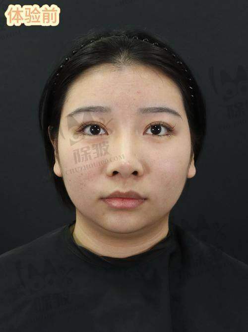 金勇圭医生预约挂号