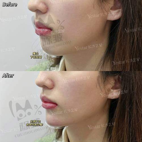 崔宇景医生执医荣誉