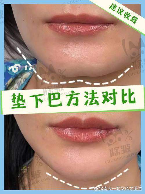 崔宇景医生预约挂号