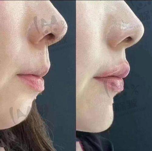 崔宇景医生擅长项目