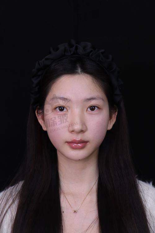 崔宇景医生口碑评价及真人实例