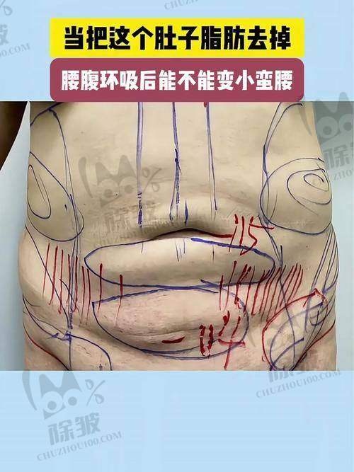 顾海峰医生预约挂号