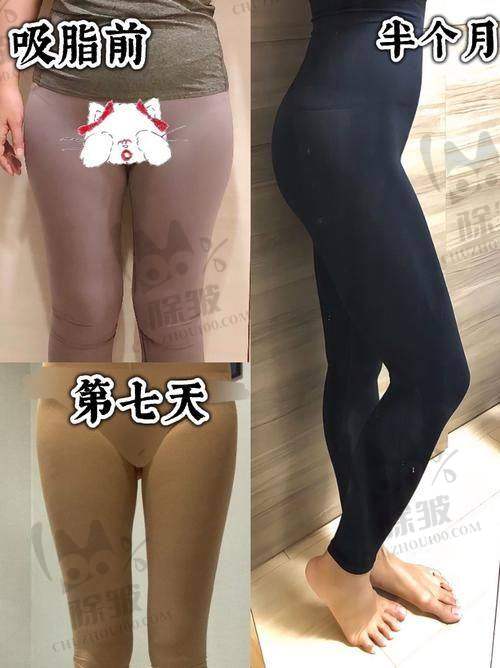 顾海峰医生技术优势