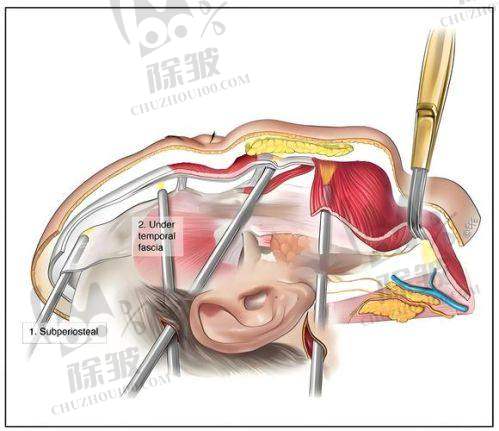 张晓棠医生口碑评价及真人实例