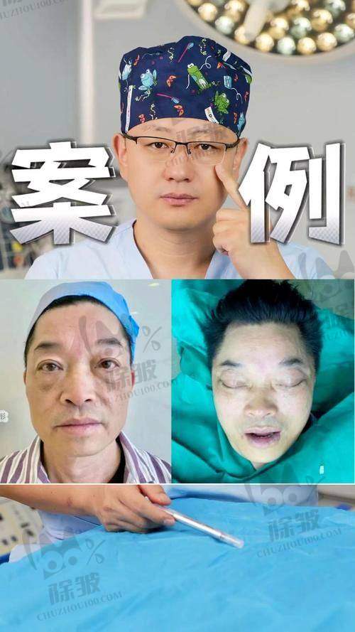 金勇圭医生价格表