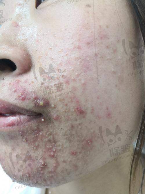 昆山容妍整形杨帆医生坐诊医院