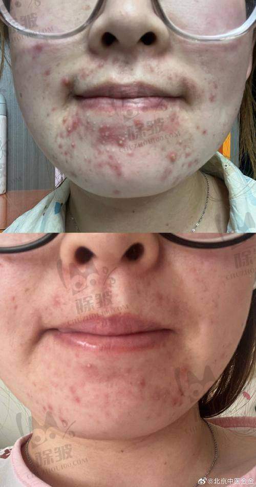 昆山容妍整形杨帆医生执医荣誉