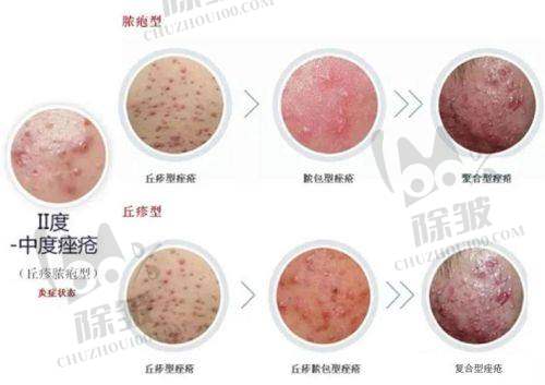 昆山容妍整形杨帆医生擅长项目