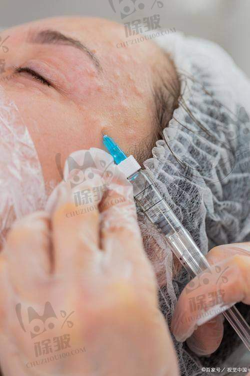 周强医生坐诊医院