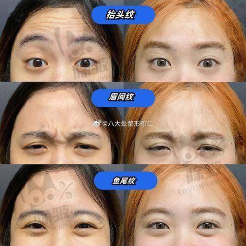 周强医生技术优势