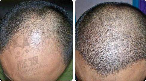 昆山容妍整形杨帆医生预约挂号