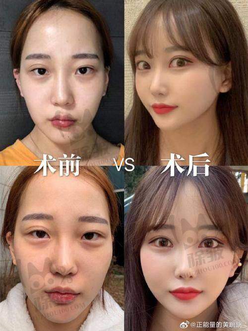 周强医生口碑评价及真人实例